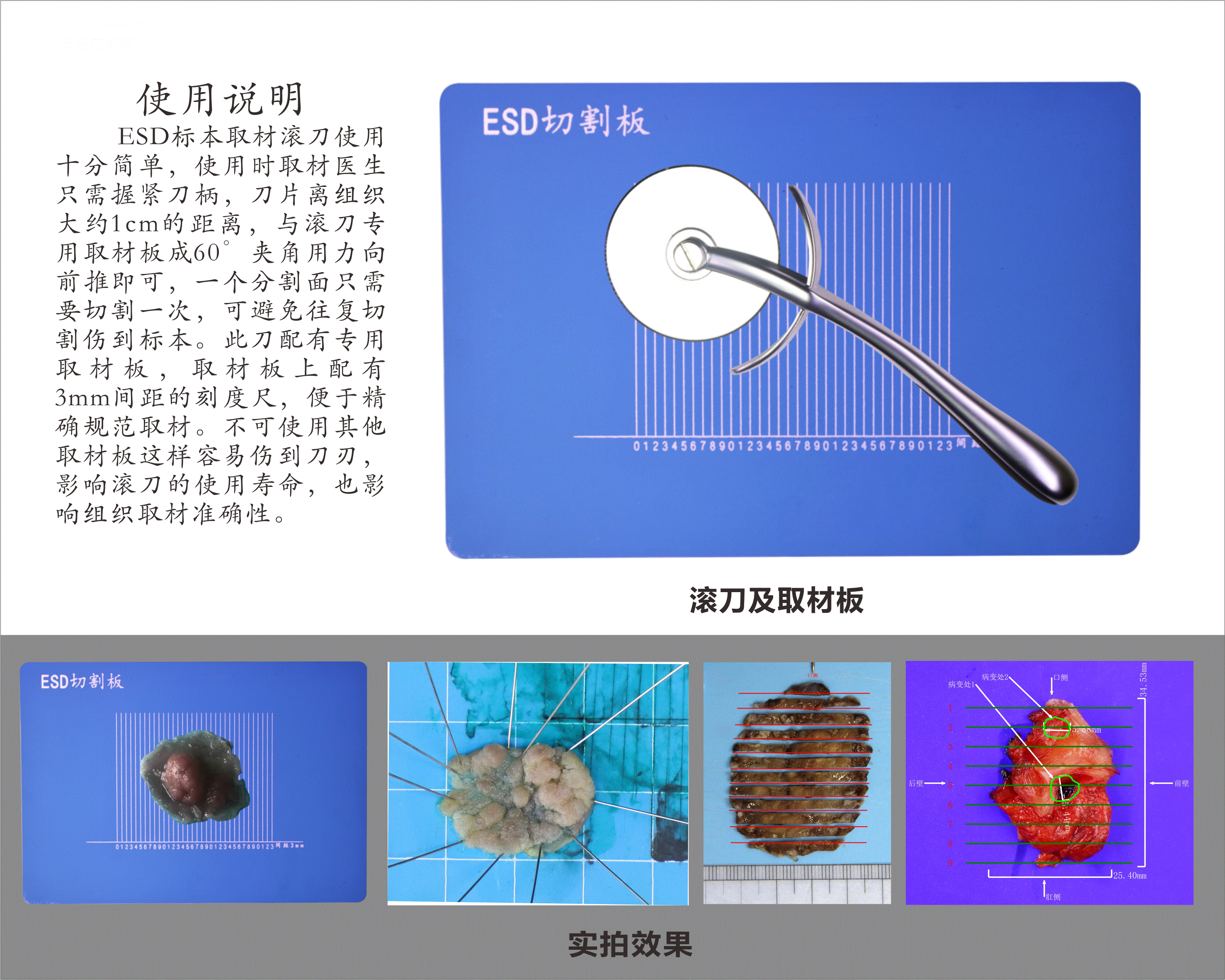 ESD標本取材滾刀