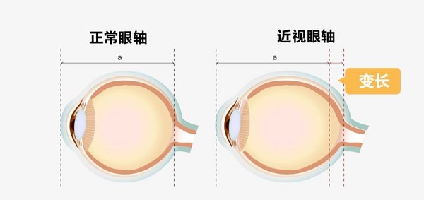 远像光屏大盘点：京东方健康远望学习屏护眼综合实力胜出