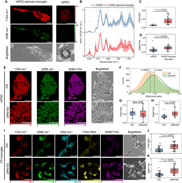又发Nature 子刊！O-PTIR光热红外显微成像技术绘制单细胞脂代谢图谱