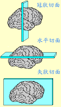 腦模具（腦槽）